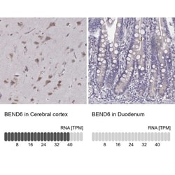 Bend6 Antibody, Novus Biologicals 0.1mL; Unlabeled:Antibodies, Polyclonal
